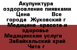 Акупунктура, оздоровление пиявками › Цена ­ 3 000 - Все города, Жуковский г. Медицина, красота и здоровье » Медицинские услуги   . Забайкальский край,Чита г.